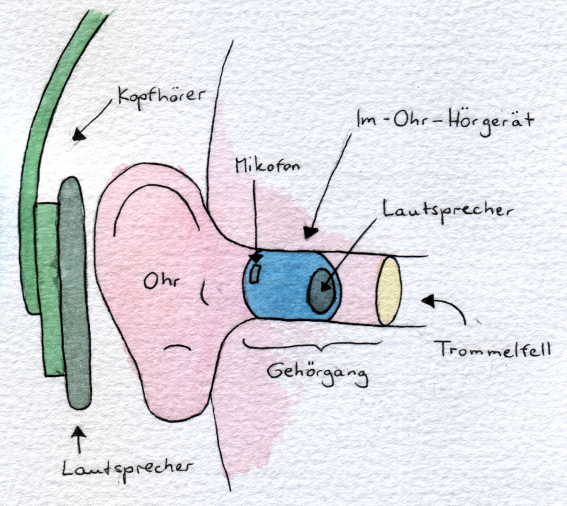 Schematische Darstellung: Ein Ohr mit On-Ear-Kopfhörern und In-Ear-Hörgeräten