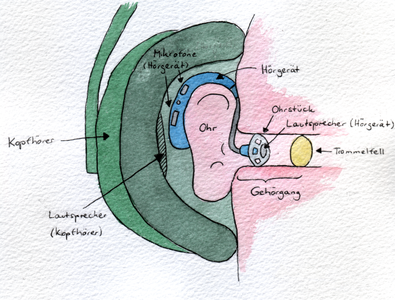 Schematische Darstellung: Ein Ohr mit Over-Ear-Kopfhörern und Hinterm-Ohr-Hörgerät