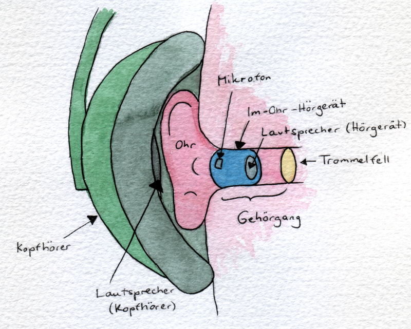 Schematische Darstellung: Ein Ohr mit Over-Ear-Kopfhörern und In-Ear-Hörgeräten