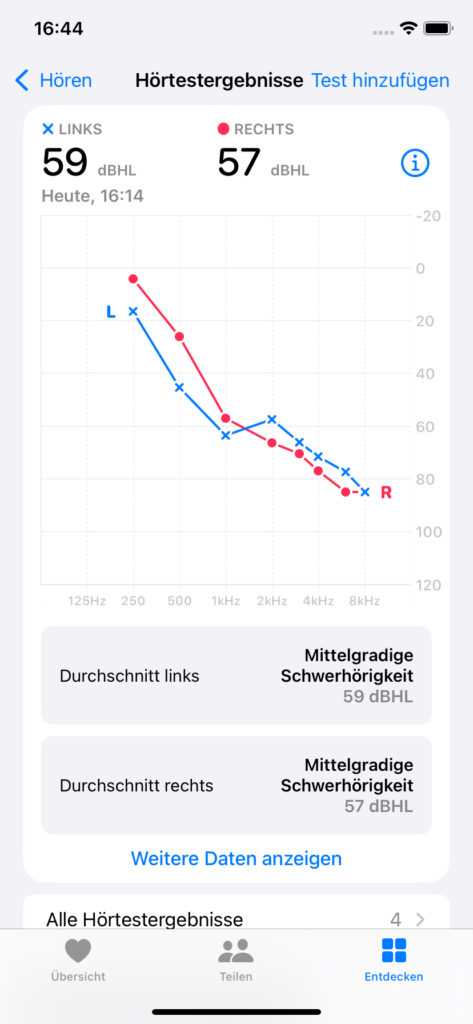 Bildschirmfoto eines Audiogrammes. Beide Linien fangen links oben an enden rechts unten bei ca. 80dB.