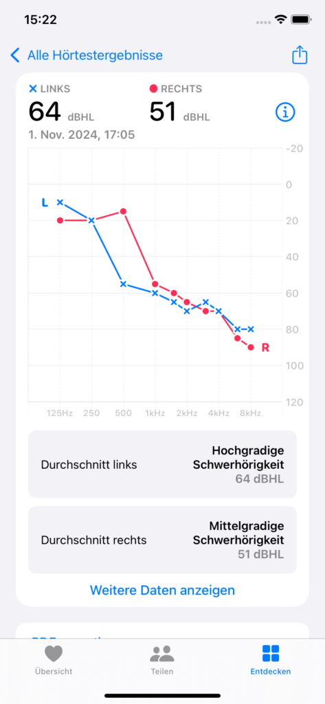 Bildschirmfoto eines manuell eingegebenen Audiogrammes. Beide Linien fangen links oben an enden rechts unten bei ca. 85dB.